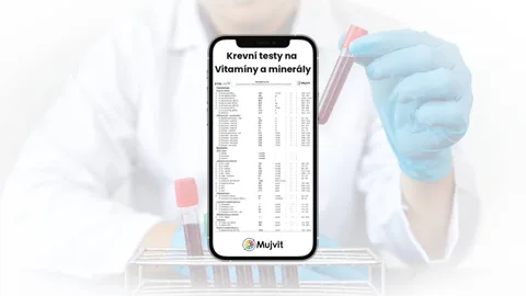 Krevní testy Mujvit